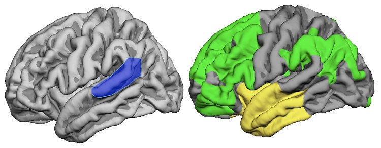 Ridisegnata la mappa del linguaggio nel cervello