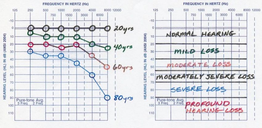 Audiogram Norms hearing loss at different ages