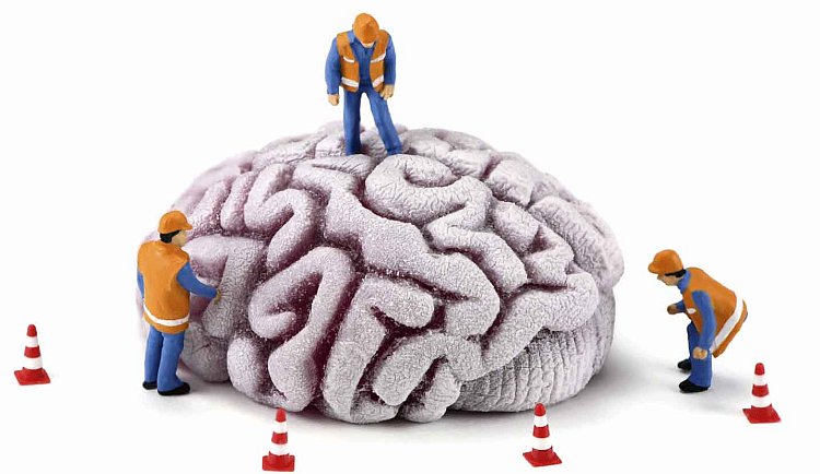 Cosa succede al cervello con l'Alzheimer?