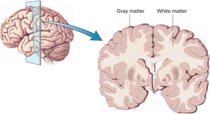 La distinzione iniziale tra Alzheimer e demenza frontotemporale