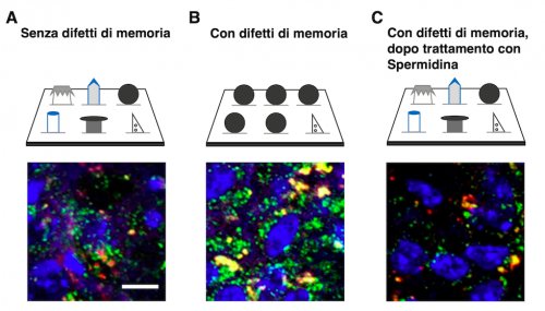 Effects of spermidin on memory