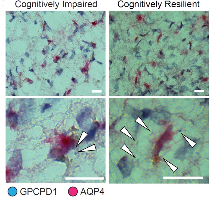 Expression of the gene GPCPD1 in astrocyte cells