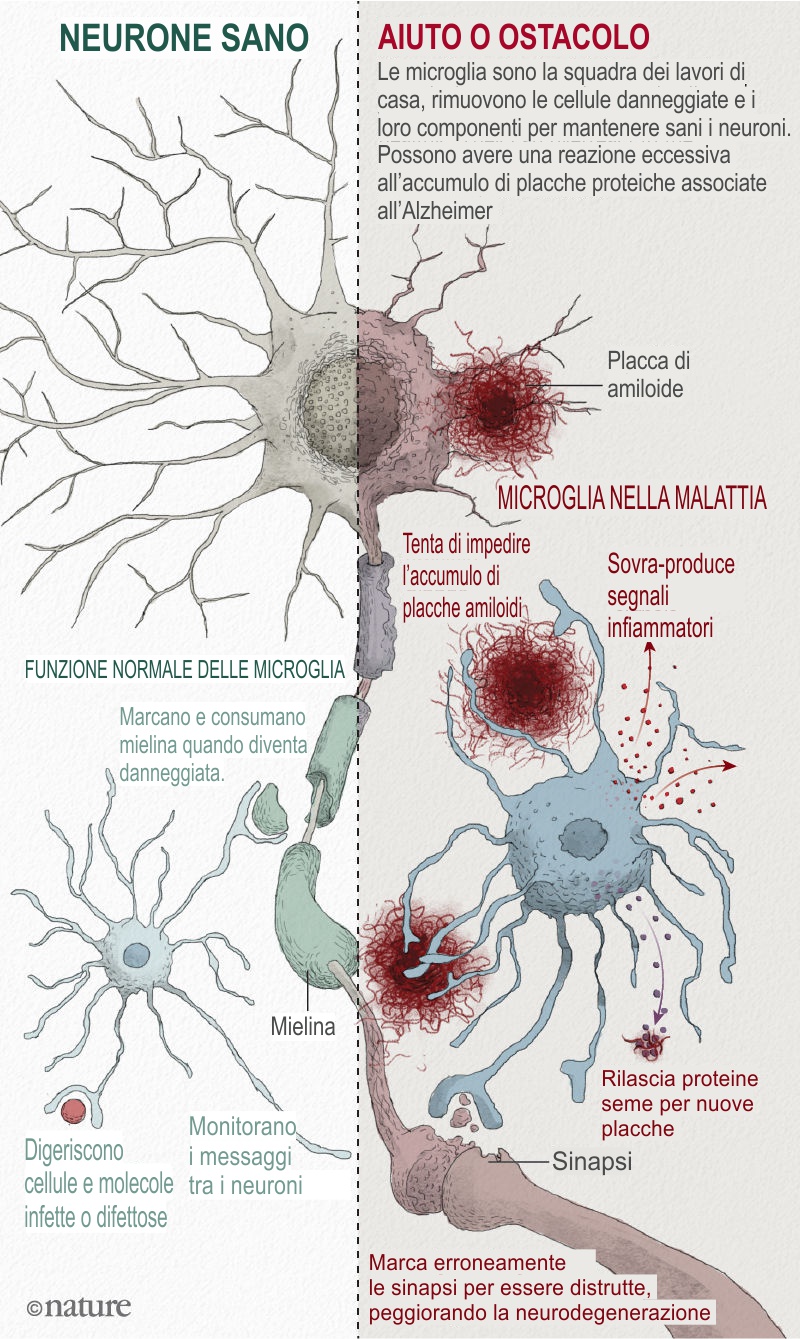 Microglia function healthy vs diseased