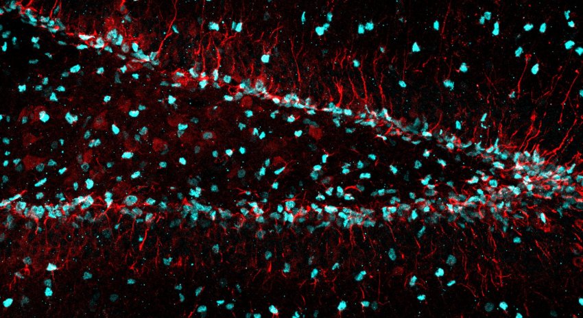 Neural stem cells in the brain labeled by vimentin in red and Sox2 in cyan