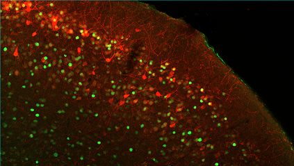 Neuroni della corteccia entorinale laterale