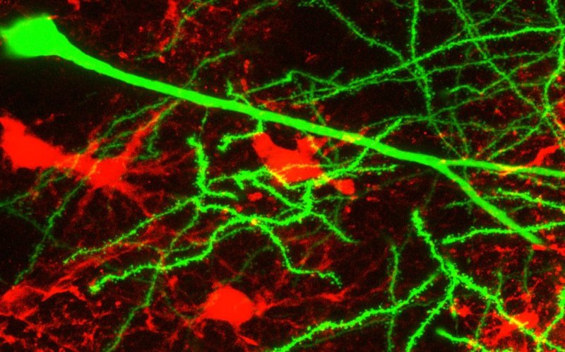 Neurons-and-astrocytes.jpg