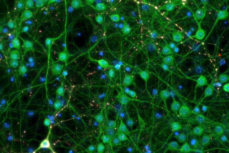 Neurons green with tau aggregates red 