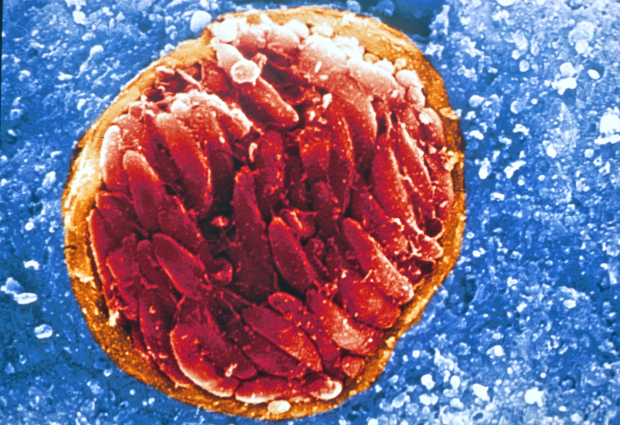 Infezione da Toxoplasma legata a varie malattie, compreso l'Alzheimer
