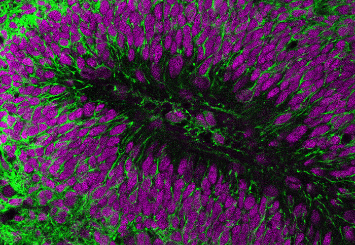 Transplanted human cells green and nuclei purple