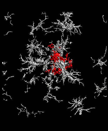 amyloid beta plaque red surrounded by microglia lacking TAM receptors white
