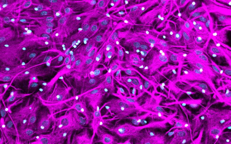 astrocytes by Alice Braga UCL