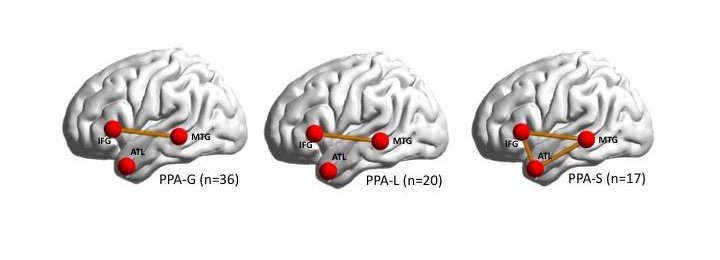 brain regions associated with speech