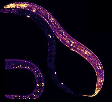 c elegans under microscope 