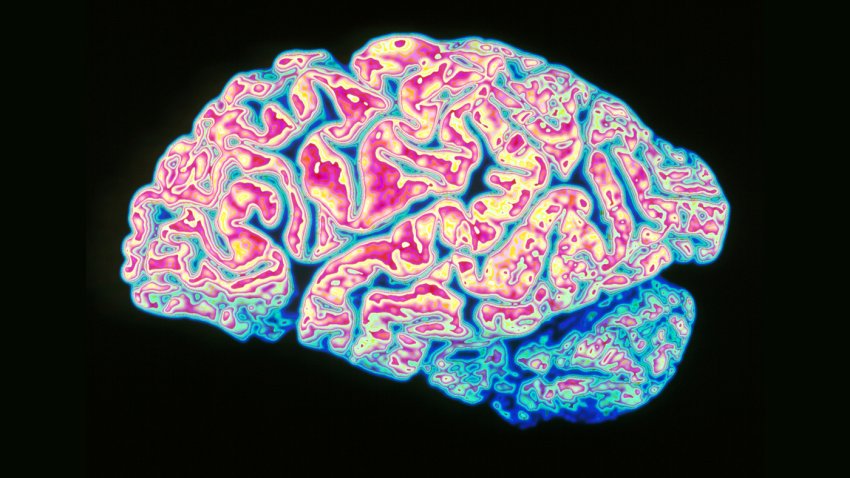 coloured brain