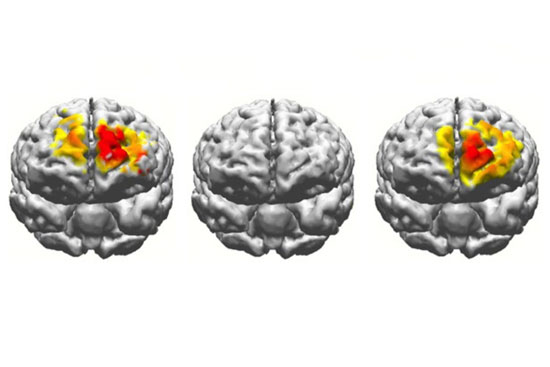 electrostimulation brain comparison