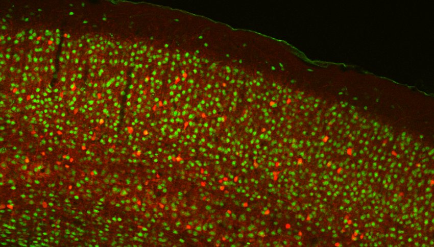 excitatory green and inhibitory red neurons in mouse cortex