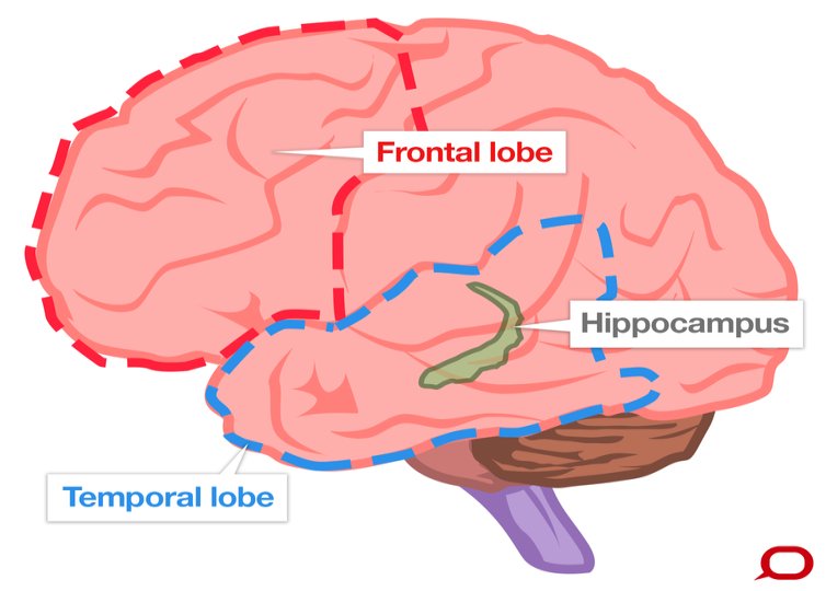 frontal, temporal lobes and hippocampus