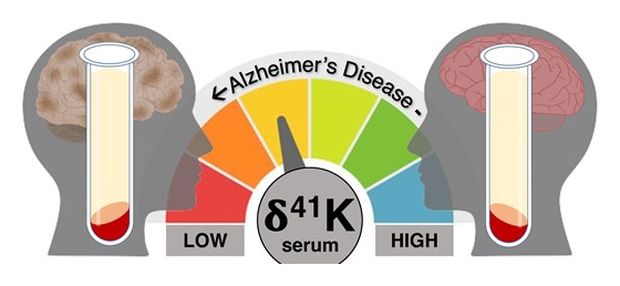 k isotope biomarker alzheimer