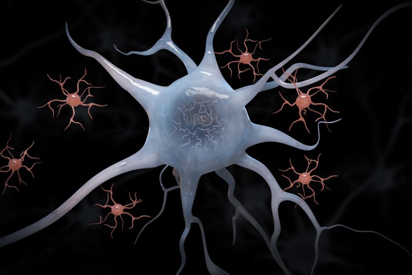 microglia and neuron with tau tangles