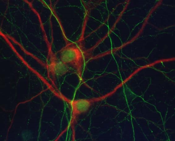 neuronal cell culture with dendritic marker in red and neurofilament axon in green