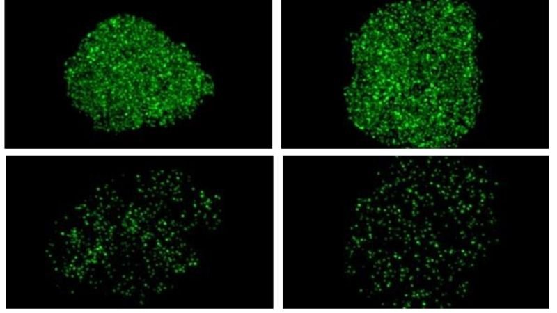 nuclear pore protein top and brain cells mutated with less protein bottom